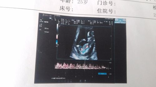 前三个月怀男孩的症状怀男孩头三个月有什么反映