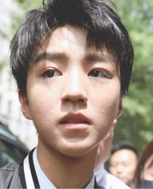 男星离开滤镜,李易峰抬头纹明显,王俊凯满脸痘痘,他竟