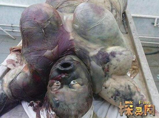 一组死人尸体照片逝者安息