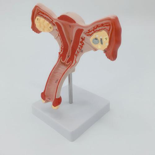 正常子宫模型 生殖科 医药礼品模型 女性子宫阴道模型 厂家直销