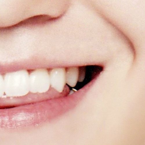 想看看镶金牙的爱豆