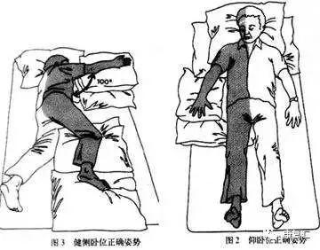 【脑梗康复】厉害了!