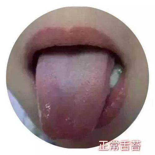 偷偷告诉你,这几个方法可以把感冒扼杀在摇篮里!