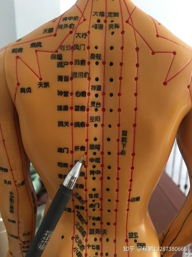 拔罐调理病症之乳腺增生