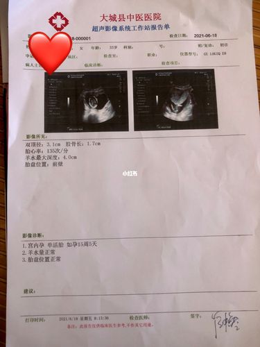 怀孕14周 4 做b超娃大了一周零一天_b超_怀孕_焦虑_孕期_胎动_母婴_孕