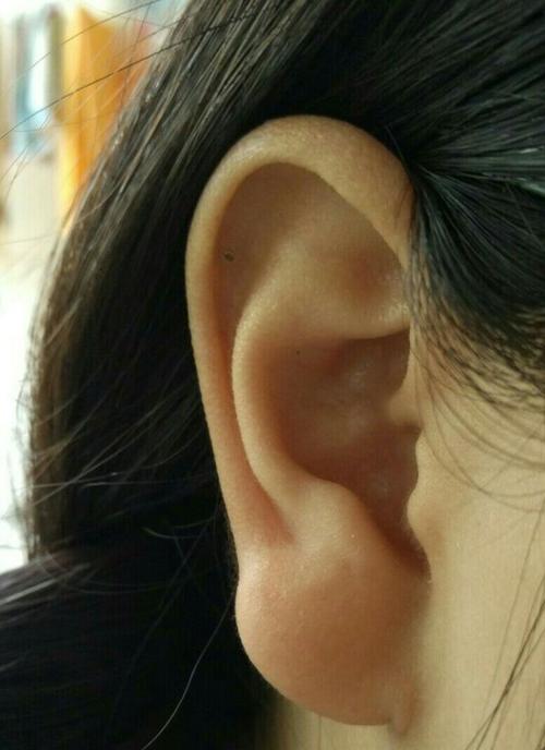 人体构造  同样的困惑……耳朵继承爸爸的厚耳垂大耳垂还有一点上翘