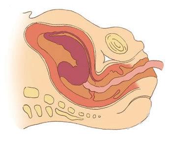 胎儿经过产道的整个过程组图