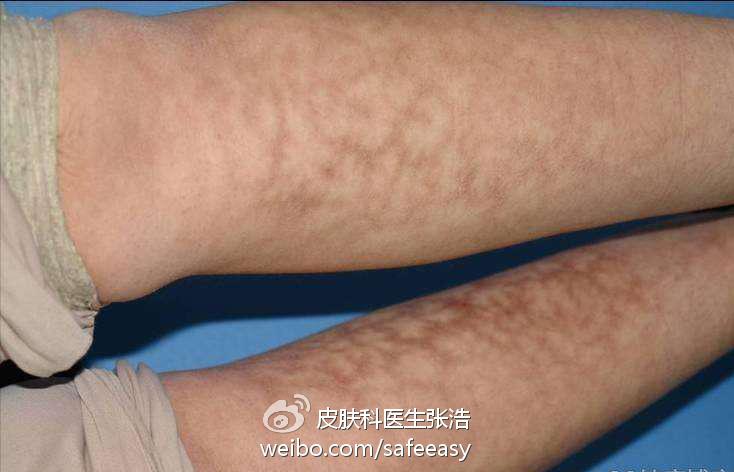 蜘蛛网不可怕寒冬秋裤是真爱