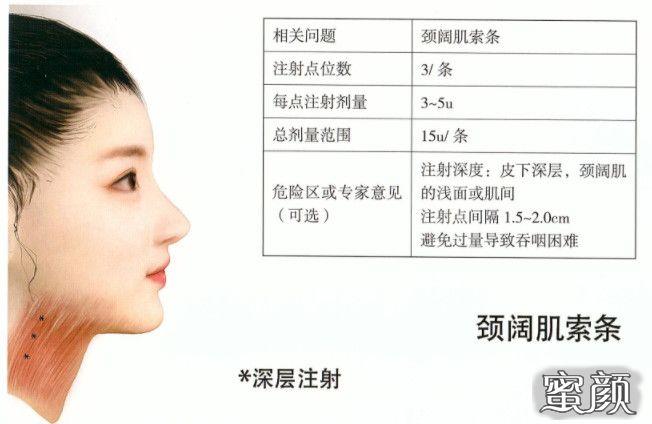 图14-11肉毒毒素注射治疗颈阔肌索条要点