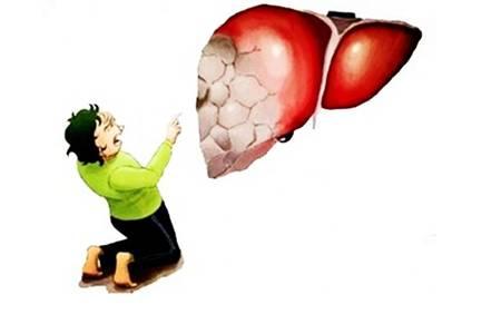 脂肪肝如何治疗和调养