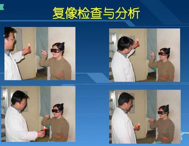 ppt病例讲解:复视诊断中的一些问题