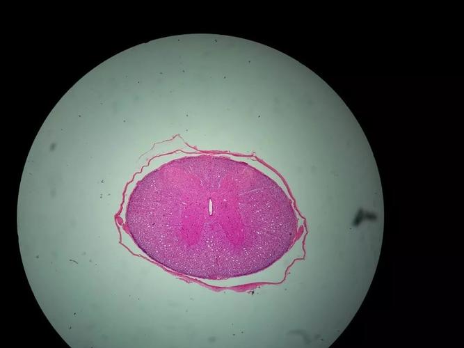 脊髓横切