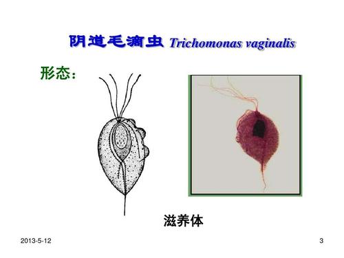 溶组织内阿米巴,结肠阿米巴ppt  阴道毛滴虫 trichomonas vaginalis