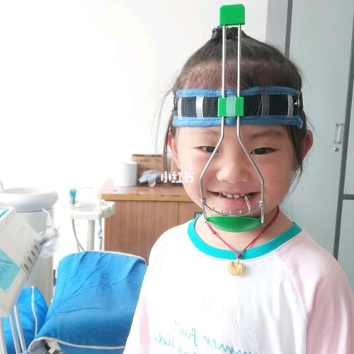 地包天矫正——牙套和前牵引_牙套_刷牙_地包天_母婴