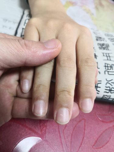 手指甲里面的这个白点呢,其实就是代表脾胃不好.消化不良.