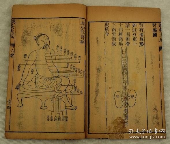 祖国珍贵中医文化遗产】清代木刻本【针灸大成】大开本存6册.