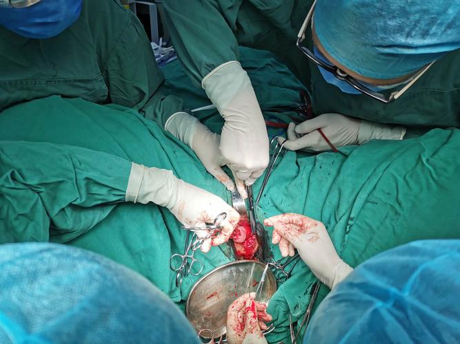 阴式全子宫切除 阴道前后壁修补术