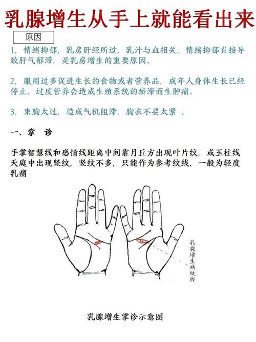 怎么从手上看出乳腺增生_乳腺增生_乳腺结节_医疗健康