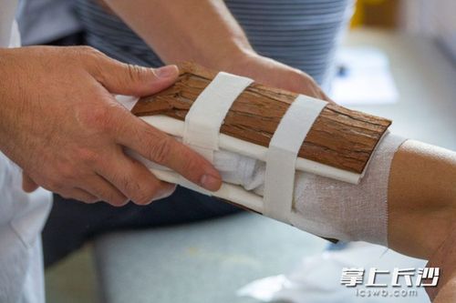 个体化小夹板固定.