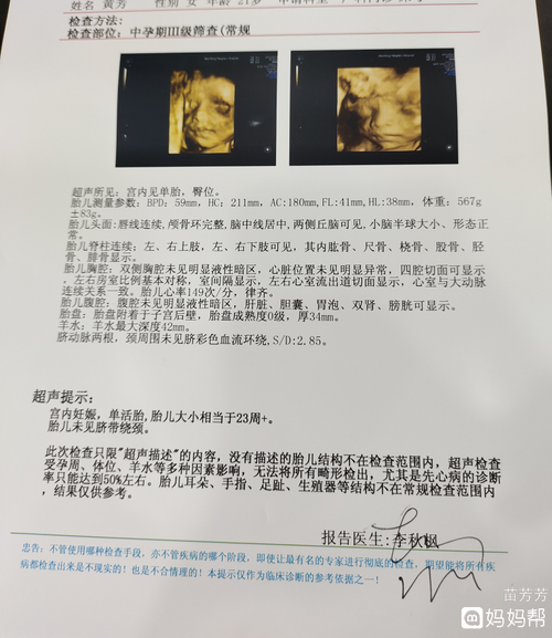 今天去做四维,宝宝很健康 ,很开心  就是好奇是男是女