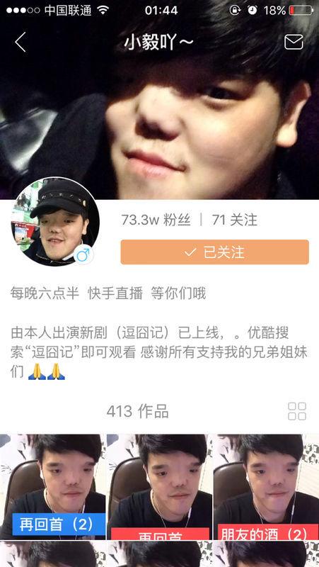 快手上那个小伙长得丑唱歌挺好听的快手号是多少