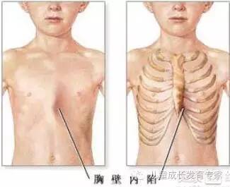 惊厥抽风的处理手抄报 家风的手抄报