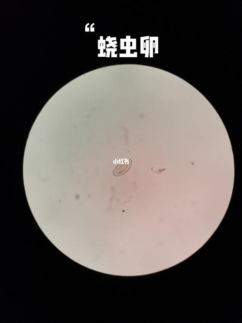 医学线虫虫卵观察_趣味知识科普_医疗健康_医疗健康