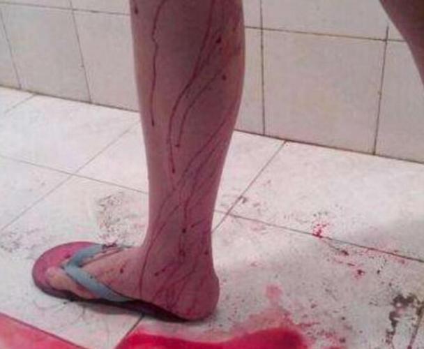 怀孕3个月"大出血", 只因她只是这样做了