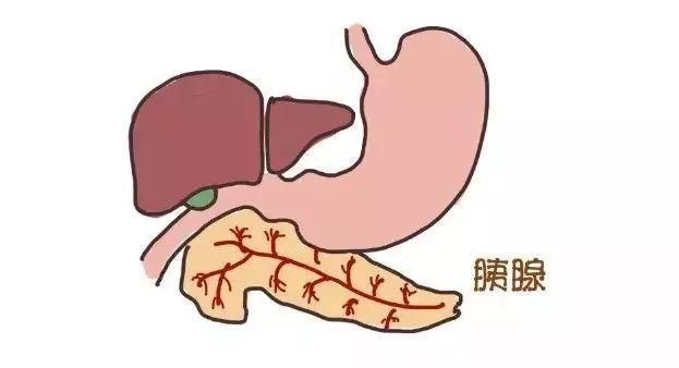 当心急性胰腺炎!