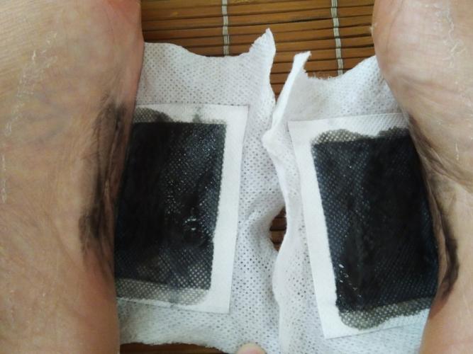 泰国纳兰足贴使用心得_兰纳化妆水怎么样_兰纳保湿样