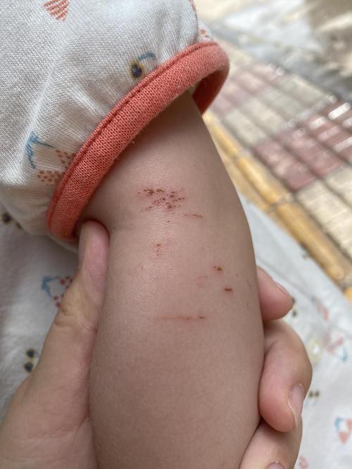 有没有养兔子的豆友解答一下疑惑,这种伤口像兔子抓的