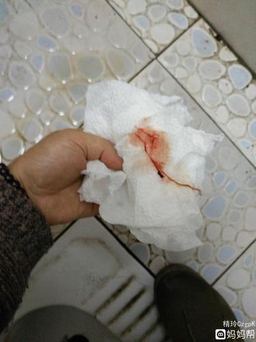 排卵期白带有血!