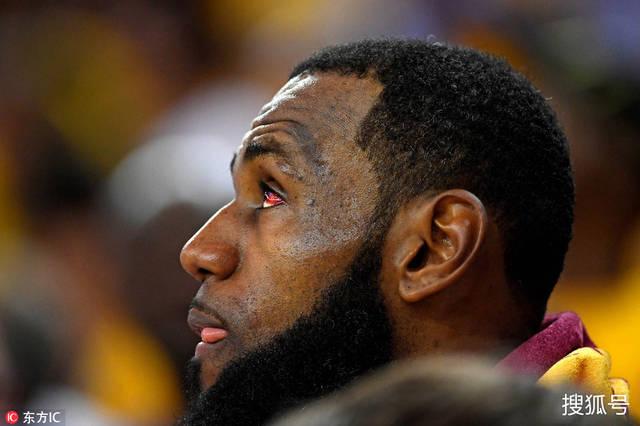 心疼!詹姆斯眼睛血红一脸疲惫 三旬老汉是否已无力对抗全世界?