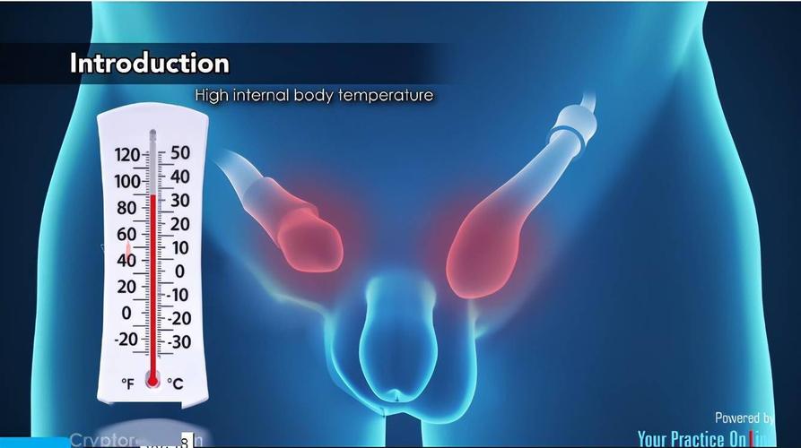 如果是双侧隐睾,即使在婴儿期进行了睾丸手术,睾丸降下来的晚,发育比
