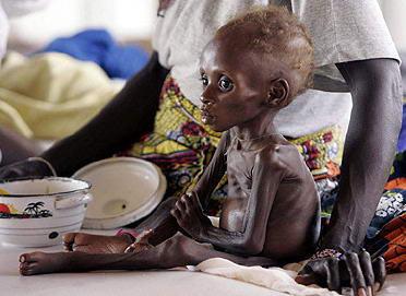 图文报道:营养不良的尼日尔儿童接受治疗