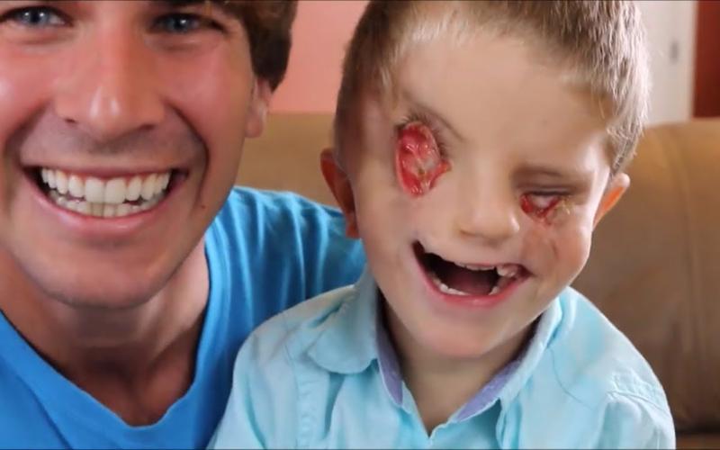 10岁男孩因患怪疾,脸部畸形扭曲,还没有眼睛!