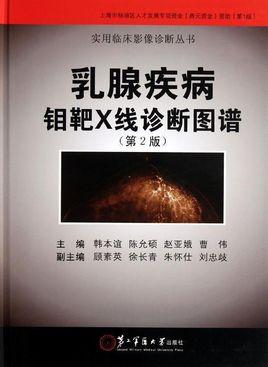 乳腺疾病钼靶x线诊断图谱