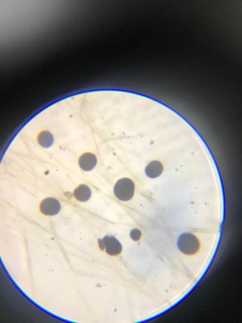 我们继续观察曲霉装片的图像.200倍显微镜下的曲霉