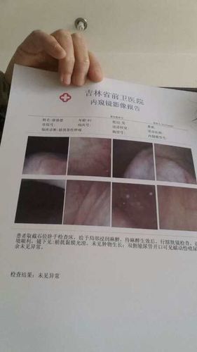 病例分享(尿路上皮癌乳头状低分化,膀胱癌)