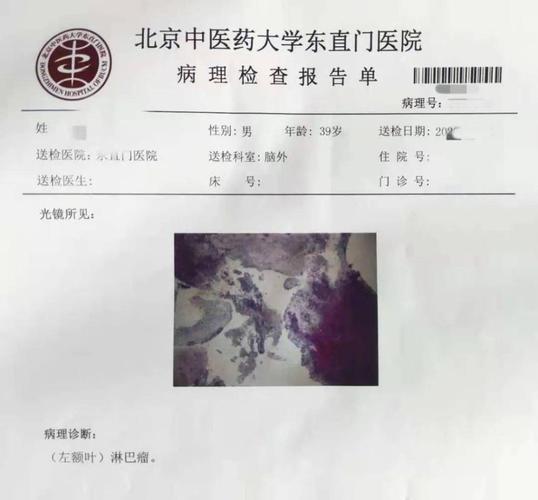 立体定向活检助力脑疑难病诊断