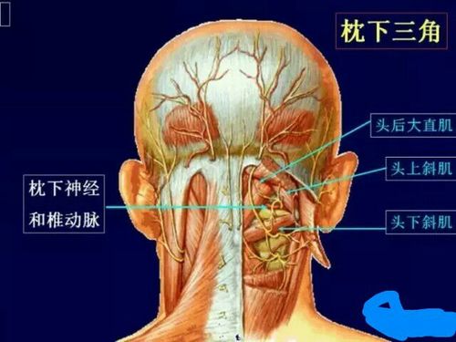 慢性头痛…诊疗分析