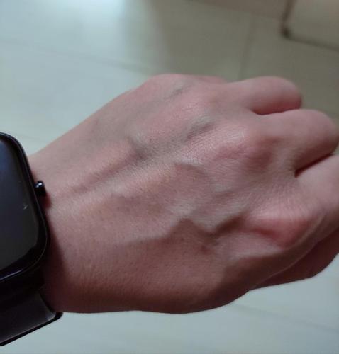 有没有人知道手背青筋突出,是什么问题