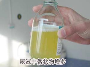 因此,若肾脏的机能正常,在尿液中出现的蛋白量只有一点点全部版本