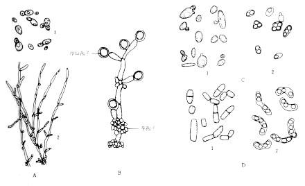 2015临床执业医师考试微生物笔记:酵母菌的繁殖