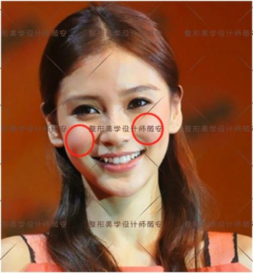 苹果肌干瘪 没有笑容力量?