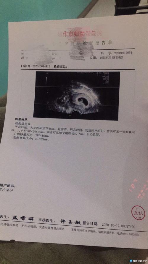 [试管婴儿]移植后30天一超,看孕囊形状谁