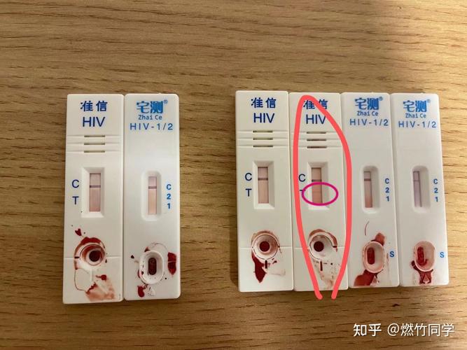 如何分辨hiv试纸的弱阳和包埋线?