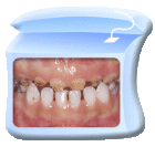 蛀牙_搜索_互动百科
