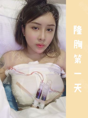 从b到d,胸大是一种什么样的体验?#合肥探店