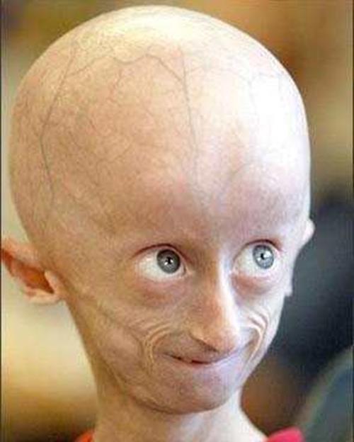 最老的小孩,脖子最长的人,鼻子最大的人